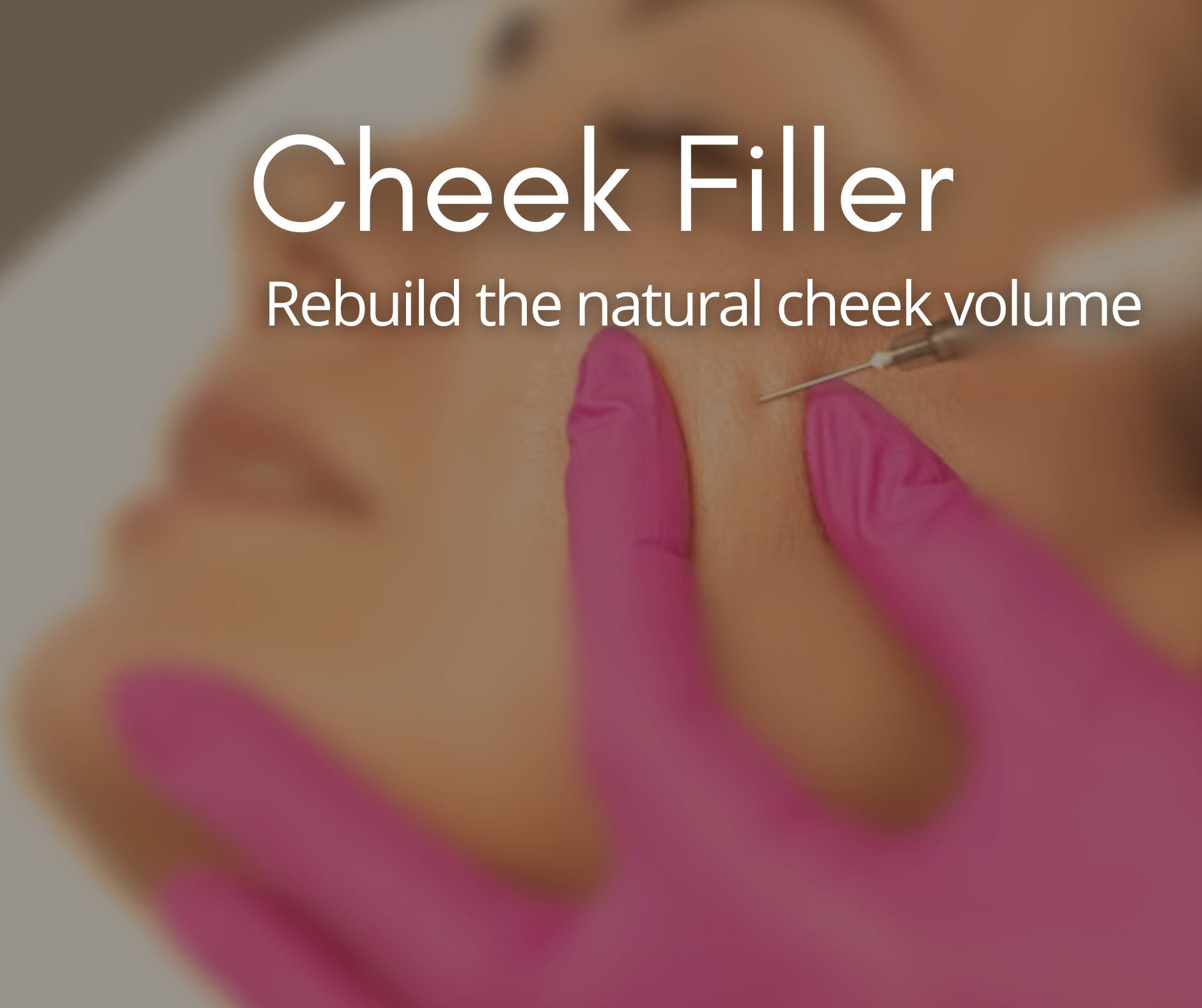 Cheek Filler