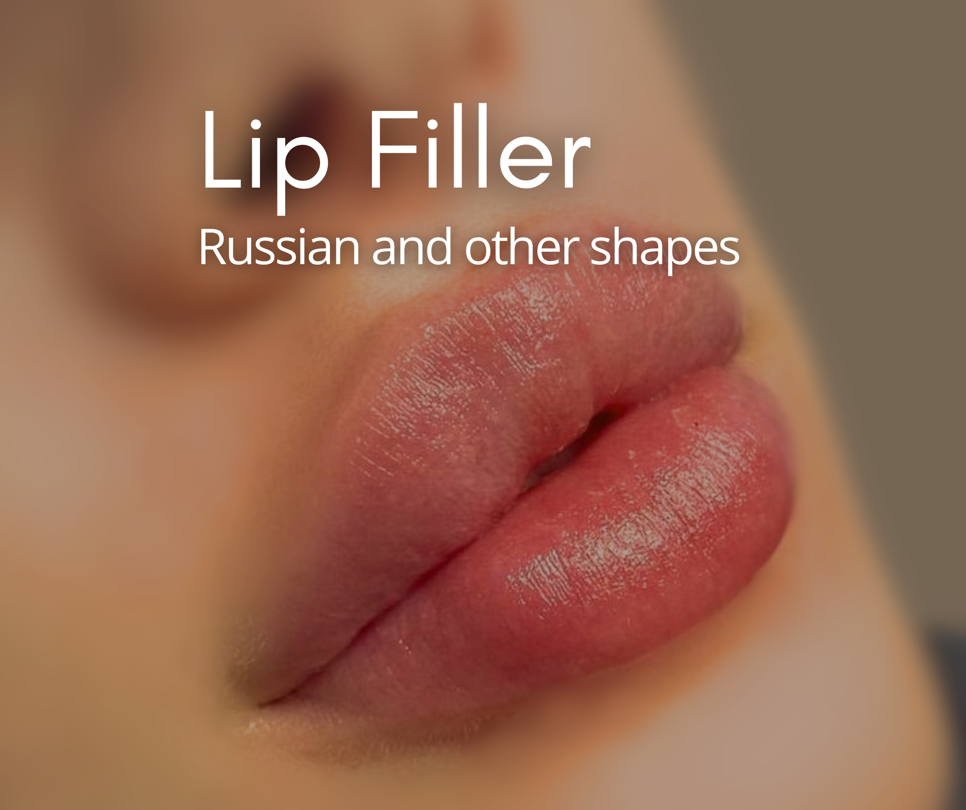 Lip Filler