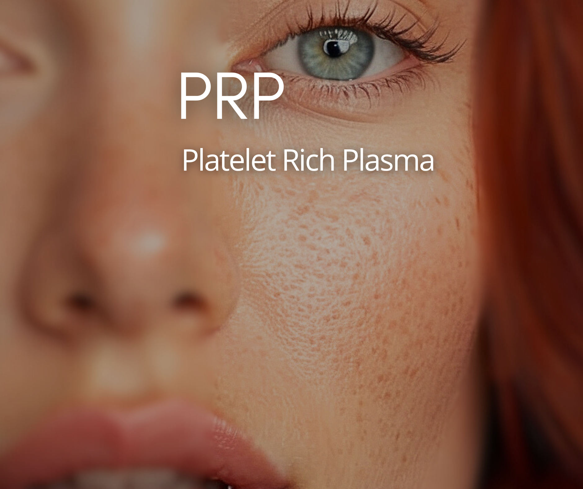 PRP