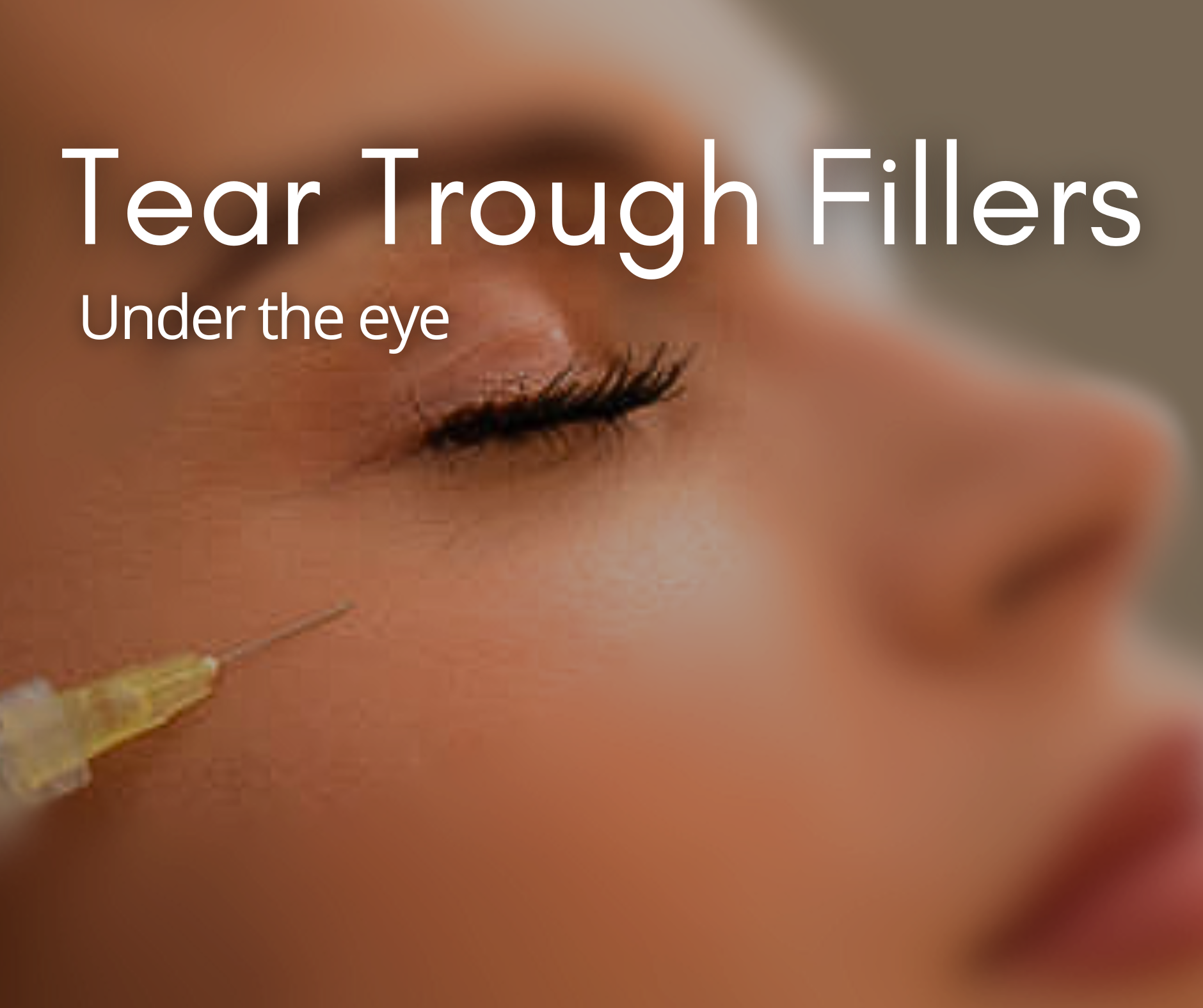 Tear Trough
